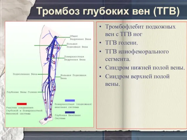 Тромбоз глубоких вен (ТГВ) Тромбофлебит подкожных вен с ТГВ ног