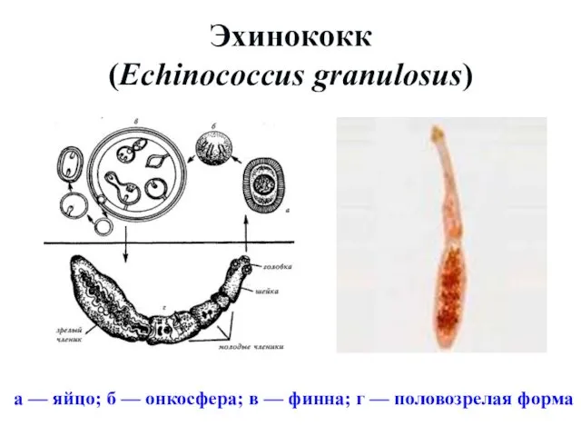 Эхинококк (Echinococcus granulosus) а — яйцо; б — онкосфера; в — финна; г — половозрелая форма