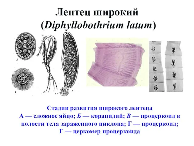 Лентец широкий (Diphyllobothrium latum) Стадии развития широкого лентеца А —