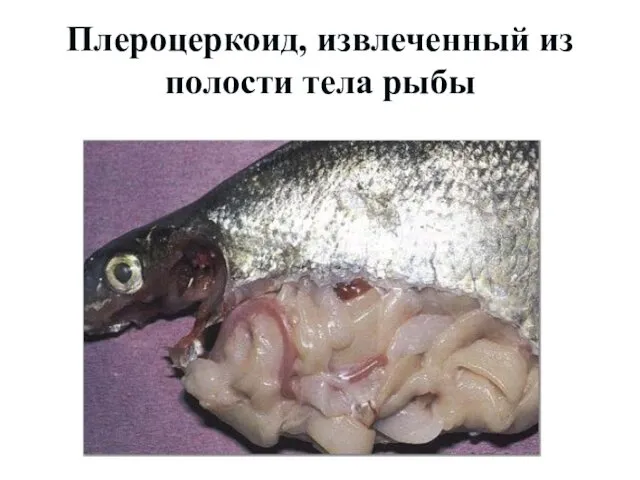 Плероцеркоид, извлеченный из полости тела рыбы