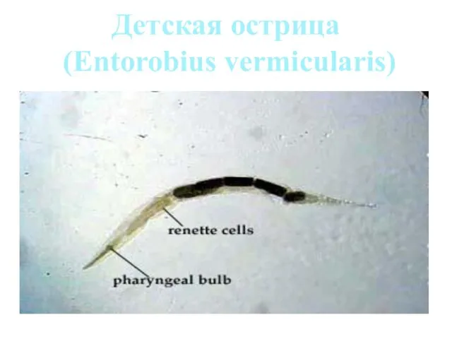 Детская острица (Entorobius vermicularis)