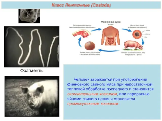 Человек заражается при употреблении финнозного свиного мяса при недостаточной тепловой
