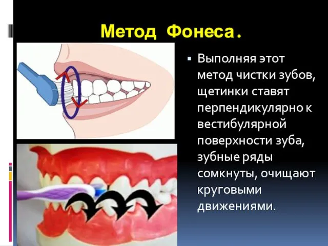 Метод Фонеса. Выполняя этот метод чистки зубов, щетинки ставят перпендикулярно