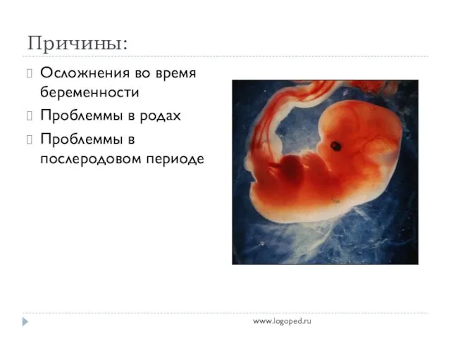 Причины: Осложнения во время беременности Проблеммы в родах Проблеммы в послеродовом периоде www.logoped.ru
