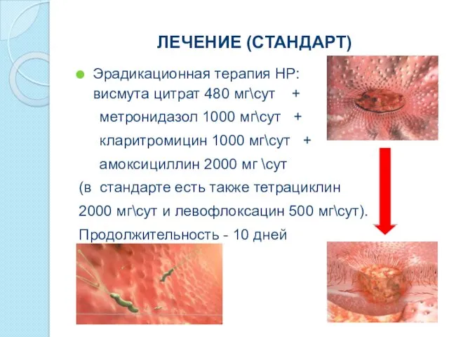 ЛЕЧЕНИЕ (СТАНДАРТ) Эрадикационная терапия НР: висмута цитрат 480 мг\сут + метронидазол 1000 мг\сут