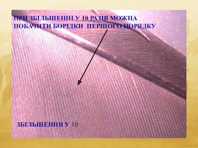 ПРИ ЗБІЛЬШЕННІ У 10 РАЗІВ МОЖНА ПОБАЧИТИ БОРІДКИ ПЕРШОГО ПОРЯДКУ