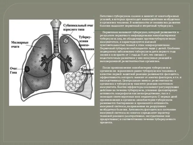 Патогенез туберкулеза сложен и зависит от многообразных условий, в которых