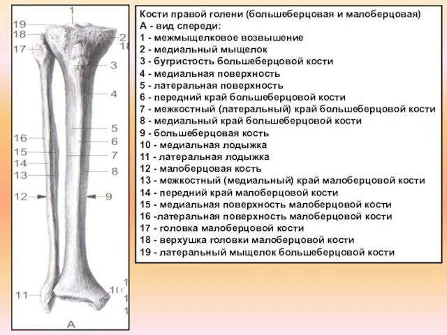 Кости правой голени (большеберцовая и малоберцовая) А - вид спереди: 1 - межмыщелковое