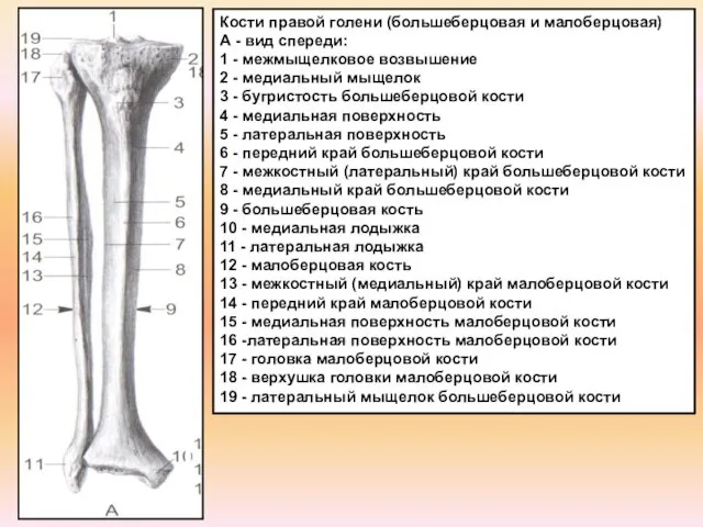 Кости правой голени (большеберцовая и малоберцовая) А - вид спереди: