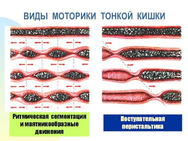 ВИДЫ МОТОРИКИ ТОНКОЙ КИШКИ Ритмическая сегментация и маятникообразные движения Поступательная перистальтика