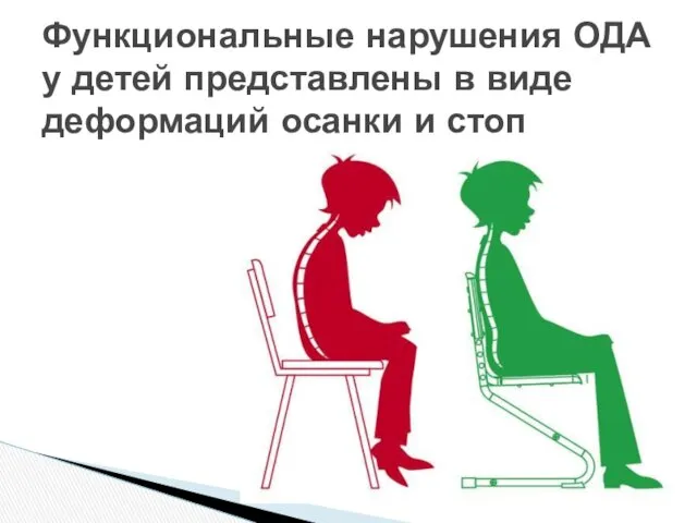 Функциональные нарушения ОДА у детей представлены в виде деформаций осанки и стоп