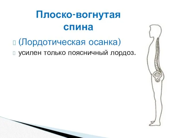 (Лордотическая осанка) усилен только поясничный лордоз. Плоско-вогнутая спина