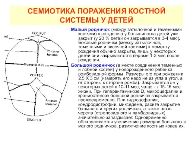 СЕМИОТИКА ПОРАЖЕНИЯ КОСТНОЙ СИСТЕМЫ У ДЕТЕЙ Малый родничок (между затылочной