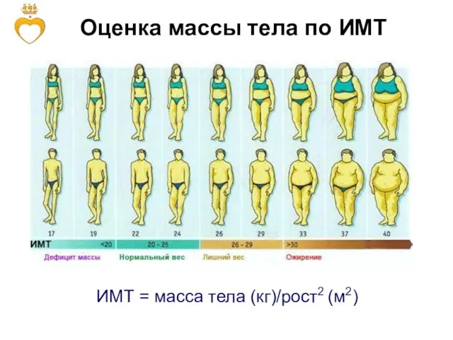 ИМТ = масса тела (кг)/рост2 (м2) Оценка массы тела по ИМТ