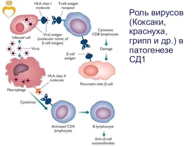 Роль вирусов (Коксаки, краснуха, грипп и др.) в патогенезе СД1