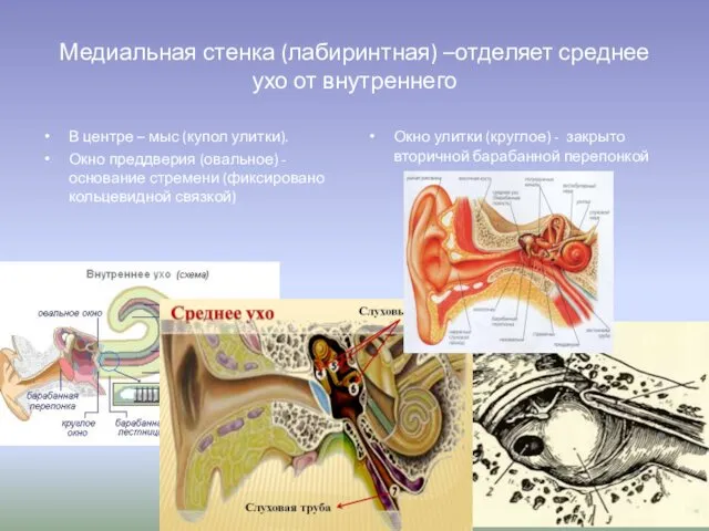 Медиальная стенка (лабиринтная) –отделяет среднее ухо от внутреннего В центре