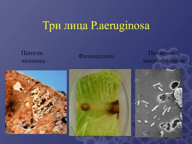 Три лица P.aeruginosa Патоген человека Фитопатоген Почвенный микроорганизм