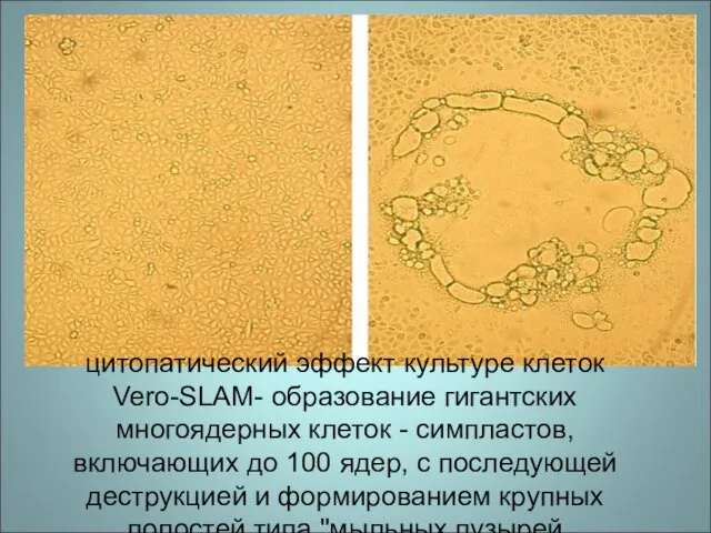 цитопатический эффект культуре клеток Vero-SLAM- образование гигантских многоядерных клеток - симпластов, включающих до