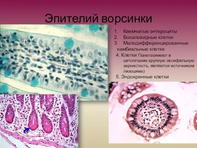 Эпителий ворсинки Каемчатые энтероциты Бокаловидные клетки Малодифференцированные камбиальные клетки 4.