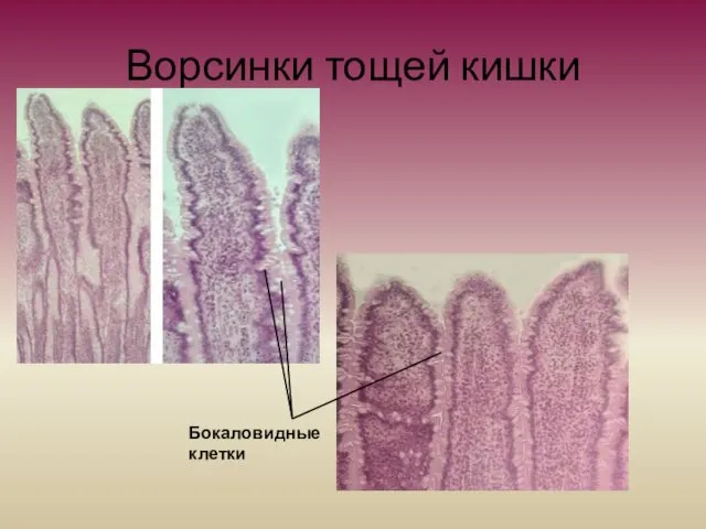Ворсинки тощей кишки Бокаловидные клетки