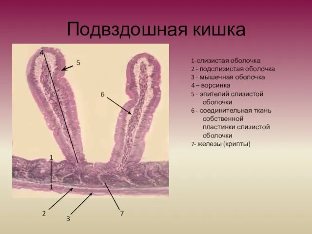 Подвздошная кишка 1 1 2 1-слизистая оболочка 2 - подслизистая