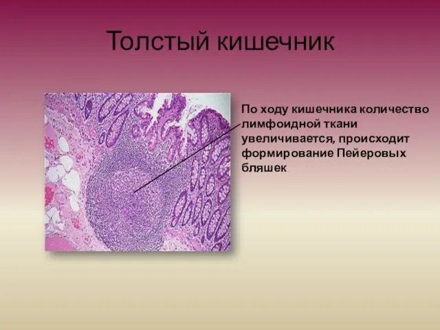 Толстый кишечник По ходу кишечника количество лимфоидной ткани увеличивается, происходит формирование Пейеровых бляшек