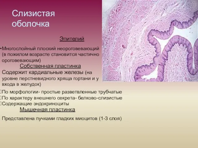 Слизистая оболочка Эпителий Многослойный плоский неороговевающий (в пожилом возрасте становится
