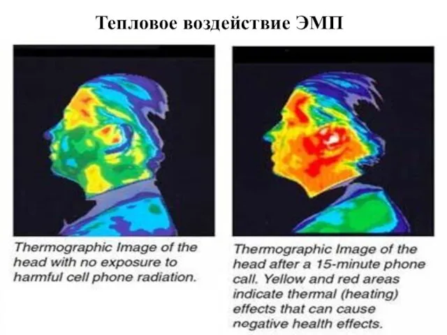 Тепловое воздействие ЭМП