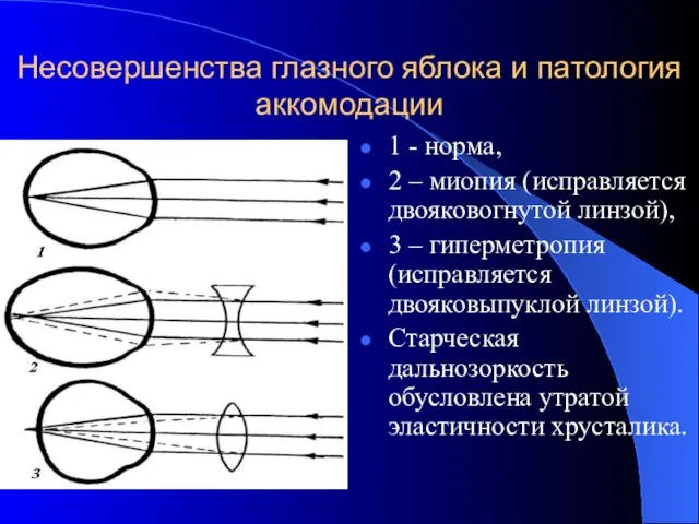 Несовершенства глазного яблока и патология аккомодации 1 - норма, 2