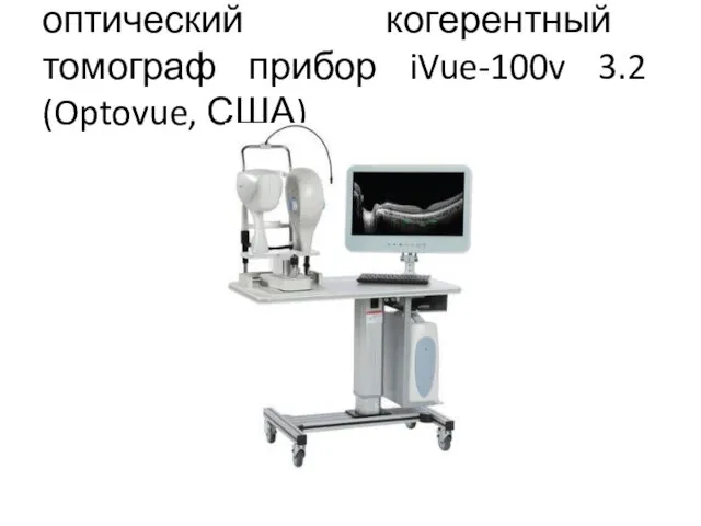 оптический когерентный томограф прибор iVue-100v 3.2 (Optovue, США)