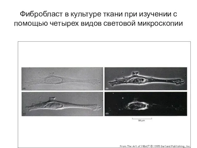 Фибробласт в культуре ткани при изучении с помощью четырех видов световой микроскопии