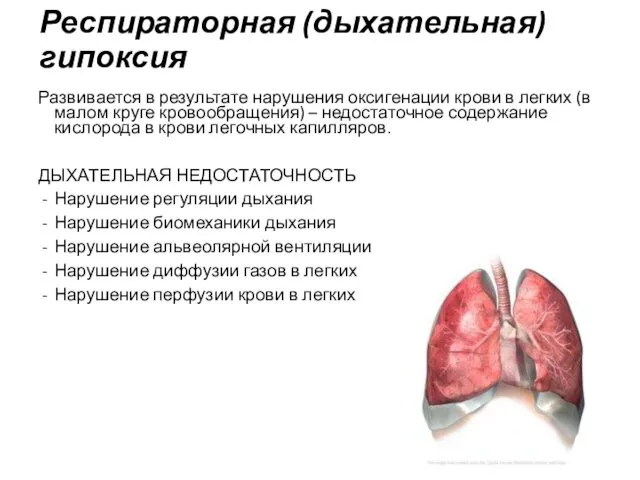 Респираторная (дыхательная) гипоксия Развивается в результате нарушения оксигенации крови в легких (в малом