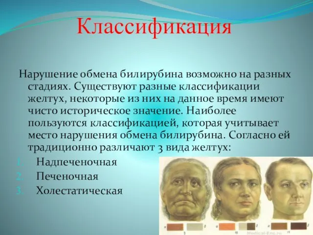 Классификация Нарушение обмена билирубина возможно на разных стадиях. Существуют разные