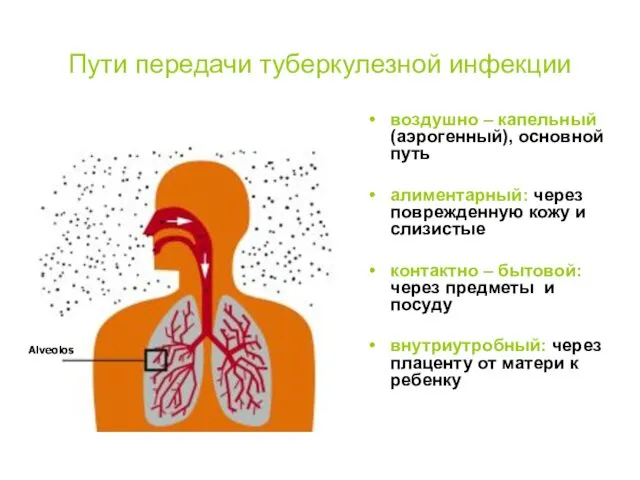 Пути передачи туберкулезной инфекции воздушно – капельный (аэрогенный), основной путь алиментарный: через поврежденную