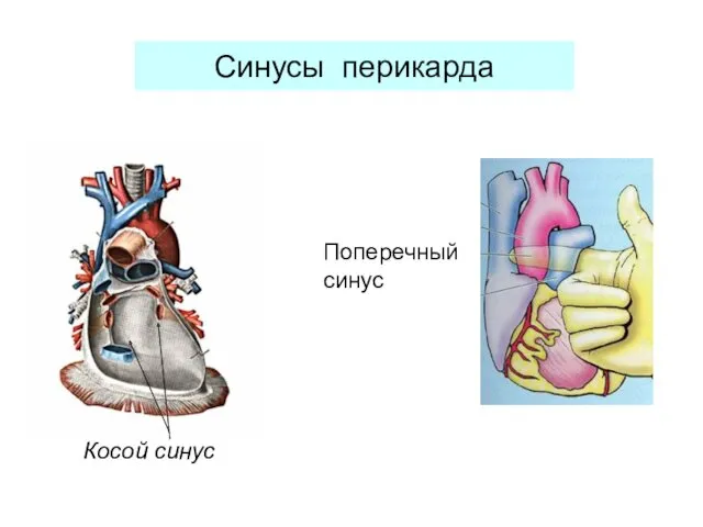 Синусы перикарда Косой синус Поперечный синус