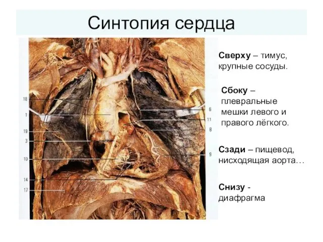 Синтопия сердца Снизу - диафрагма Сбоку – плевральные мешки левого