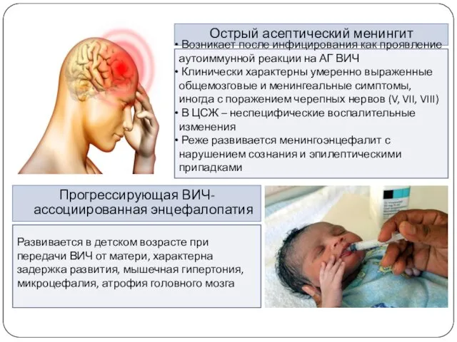 Острый асептический менингит Возникает после инфицирования как проявление аутоиммунной реакции