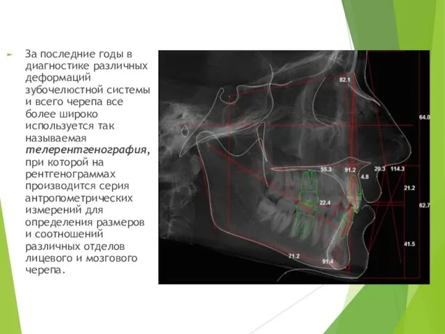 За последние годы в диагностике различных деформаций зубочелюстной системы и