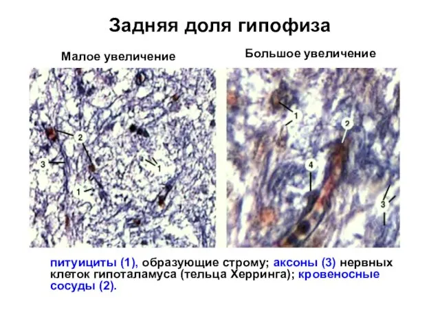 Задняя доля гипофиза питуициты (1), образующие строму; аксоны (3) нервных