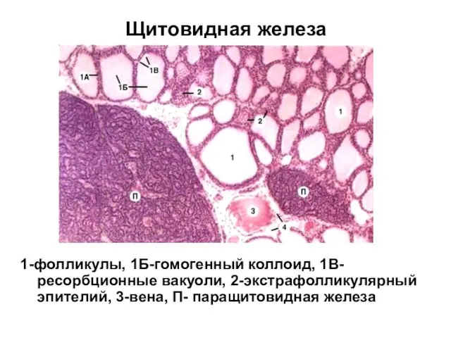 Щитовидная железа 1-фолликулы, 1Б-гомогенный коллоид, 1В-ресорбционные вакуоли, 2-экстрафолликулярный эпителий, 3-вена, П- паращитовидная железа