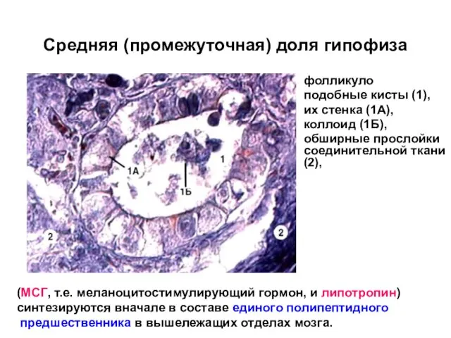 Средняя (промежуточная) доля гипофиза фолликуло подобные кисты (1), их стенка