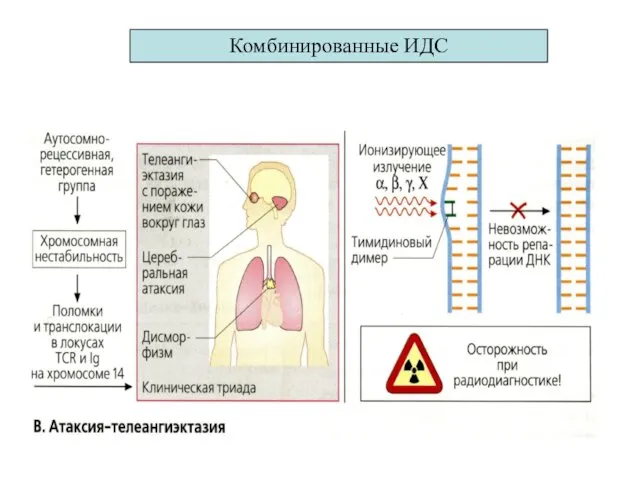 Комбинированные ИДС