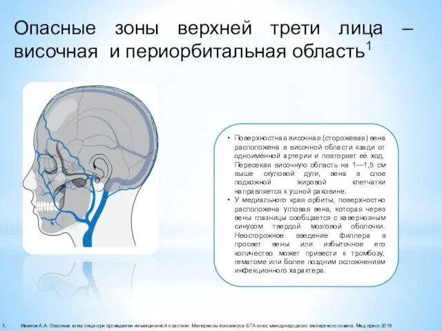 Иванов А.А. Опасные зоны лица при проведении инъекционной пластики. Материалы