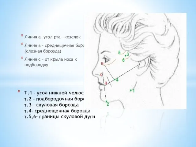 Т.1 – угол нижней челюсти т.2 – подбородочная борозда т.3-