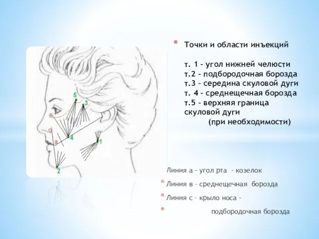 Точки и области инъекций т. 1 – угол нижней челюсти