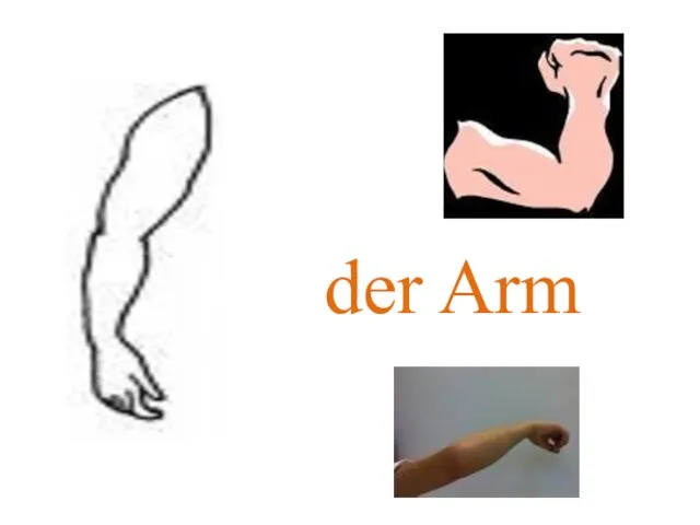 der Arm