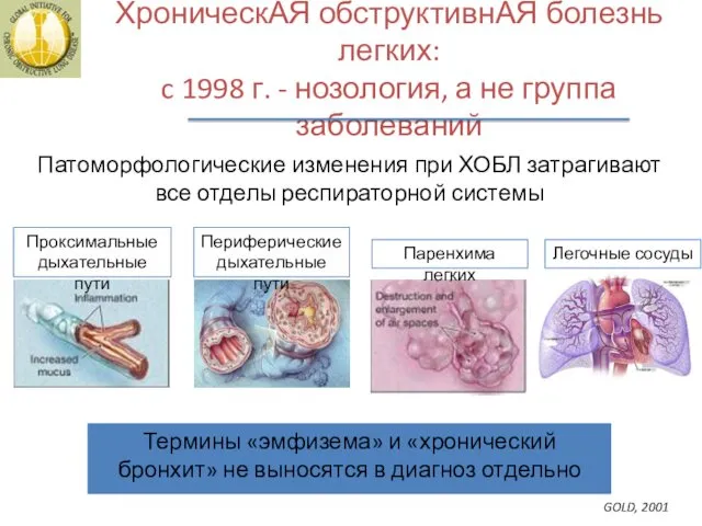 ХроническАЯ обструктивнАЯ болезнь легких: c 1998 г. - нозология, а