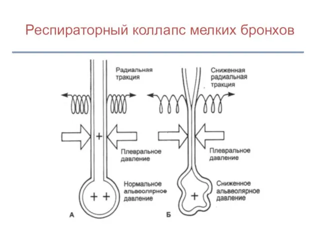 Респираторный коллапс мелких бронхов