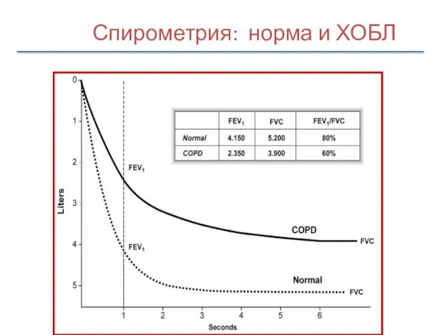 Спирометрия: норма и ХОБЛ