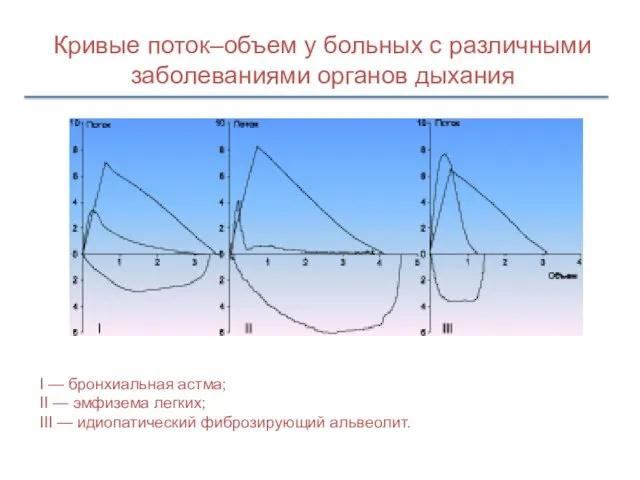 Кривые поток–объем у больных с различными заболеваниями органов дыхания I